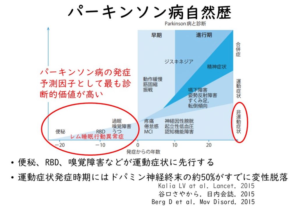 パーキンソン症状の診断・治療 ちゃたに脳神経すいみんクリニック